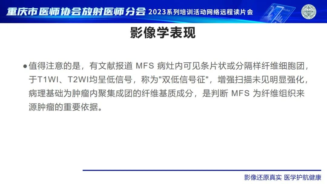 影像PPT - 【病例】大腿黏液纤维肉瘤1例MR影像-12