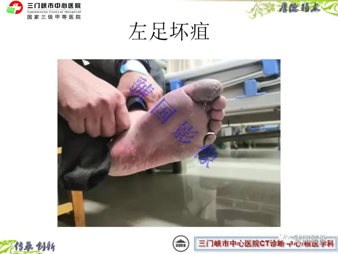 影像PPT - \ 影像PPT - \