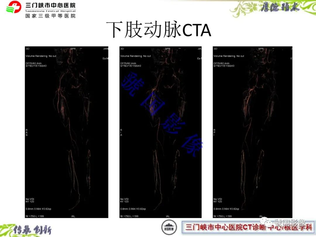 影像PPT - \ 影像PPT - \