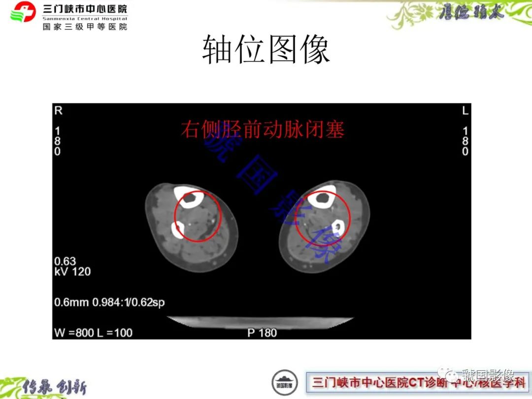 影像PPT - \ 影像PPT - \