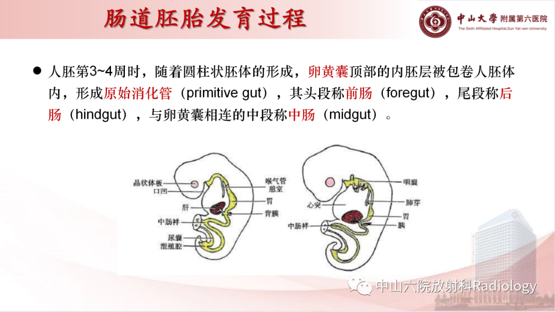 影像PPT - 【PPT】先天性肠旋转不良-3