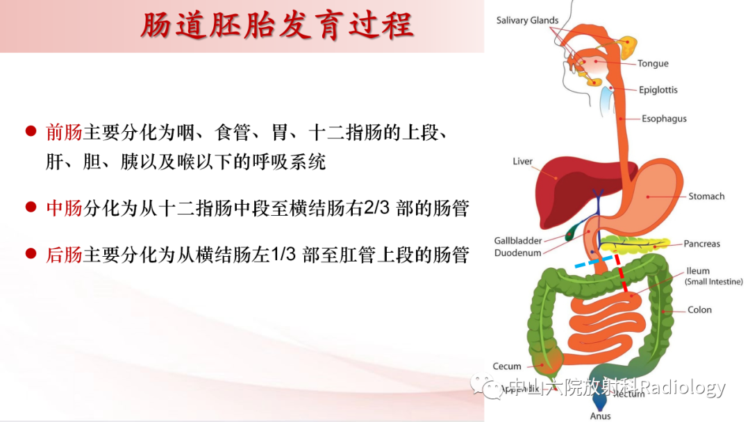 影像PPT - 【PPT】先天性肠旋转不良-4