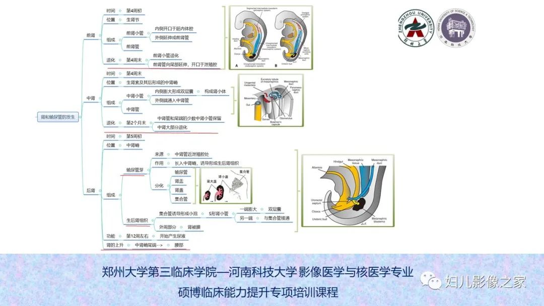 影像PPT - 【PPT】泌尿系先天性发育畸形的影像诊断-5