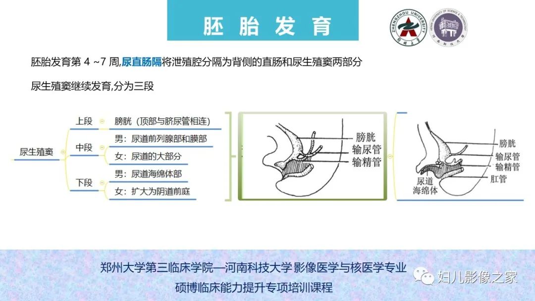 影像PPT - 【PPT】泌尿系先天性发育畸形的影像诊断-7