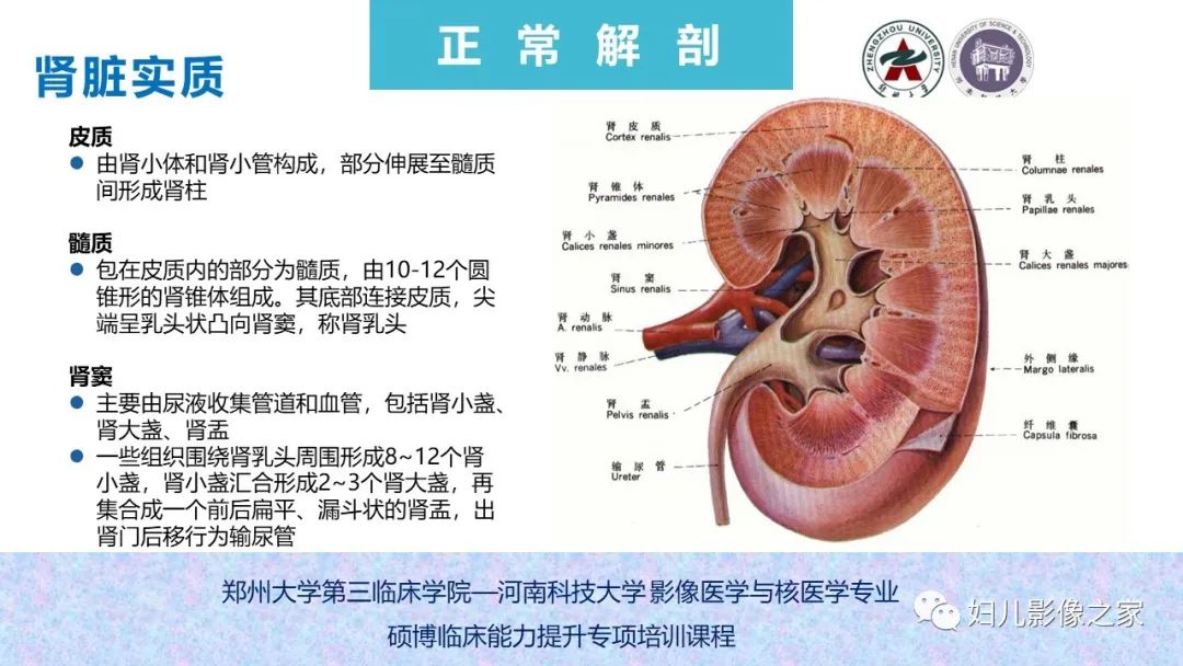 影像PPT - 【PPT】泌尿系先天性发育畸形的影像诊断-10