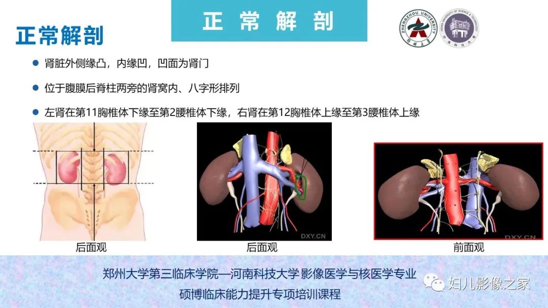 影像PPT - 【PPT】泌尿系先天性发育畸形的影像诊断-9