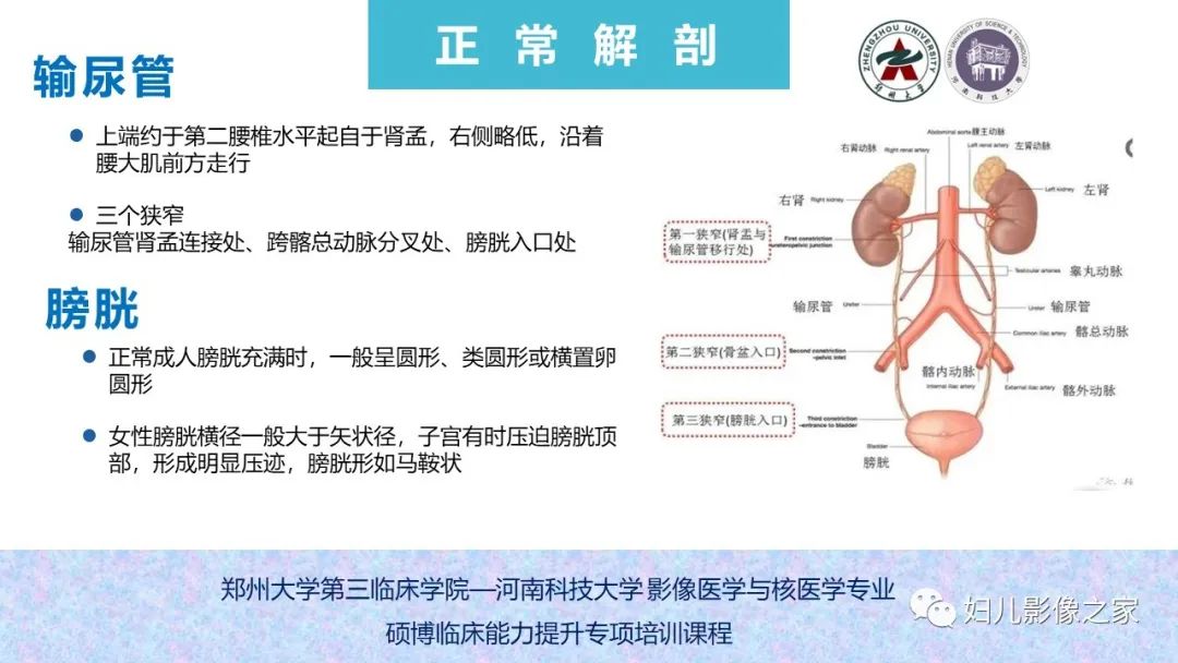 影像PPT - 【PPT】泌尿系先天性发育畸形的影像诊断-11