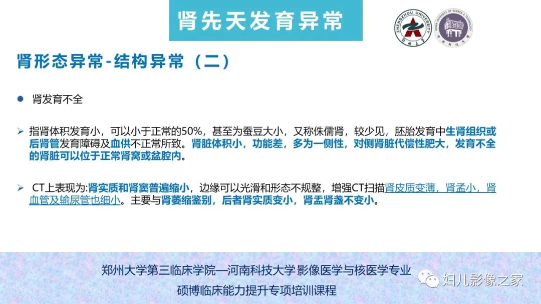 影像PPT - 【PPT】泌尿系先天性发育畸形的影像诊断-22