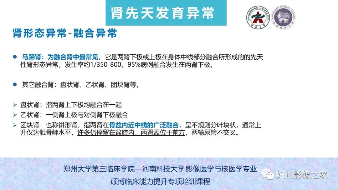 影像PPT - 【PPT】泌尿系先天性发育畸形的影像诊断-24