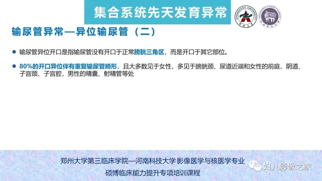 影像PPT - 【PPT】泌尿系先天性发育畸形的影像诊断-51