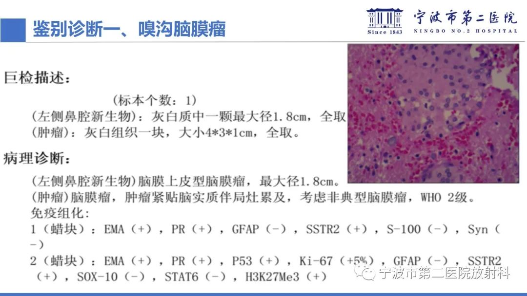 影像PPT - 【PPT】嗅神经母细胞瘤-37
