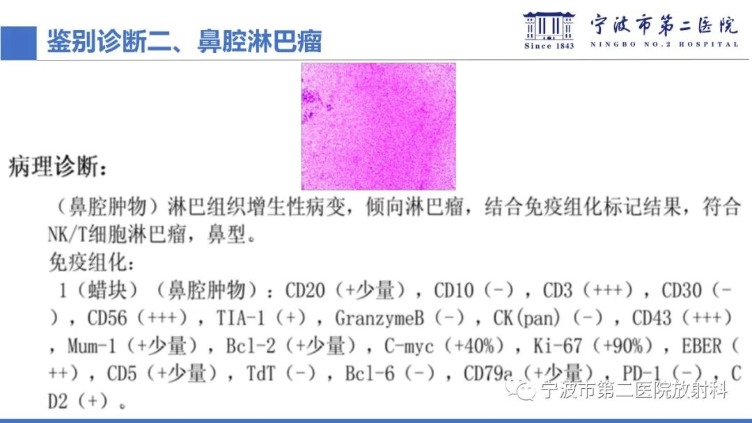影像PPT - 【PPT】嗅神经母细胞瘤-41