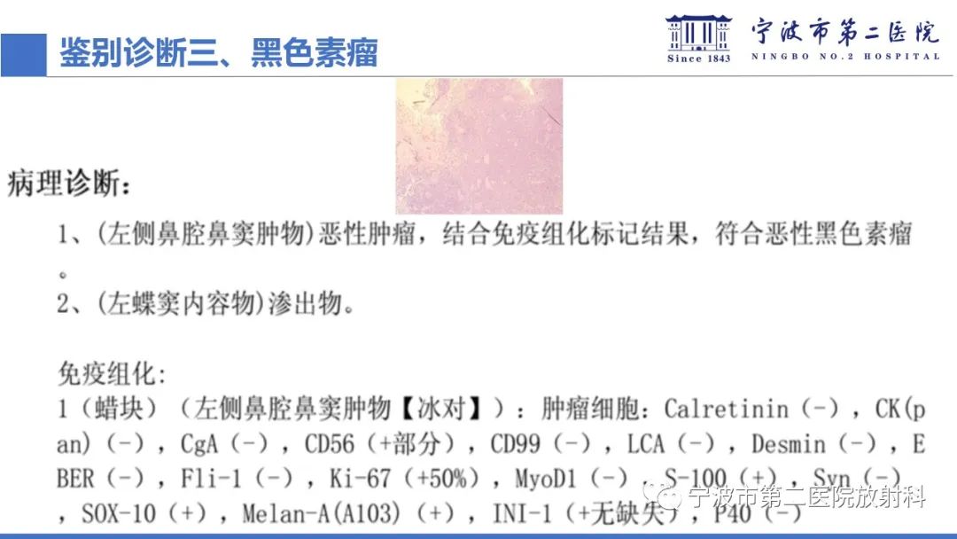 影像PPT - 【PPT】嗅神经母细胞瘤-46