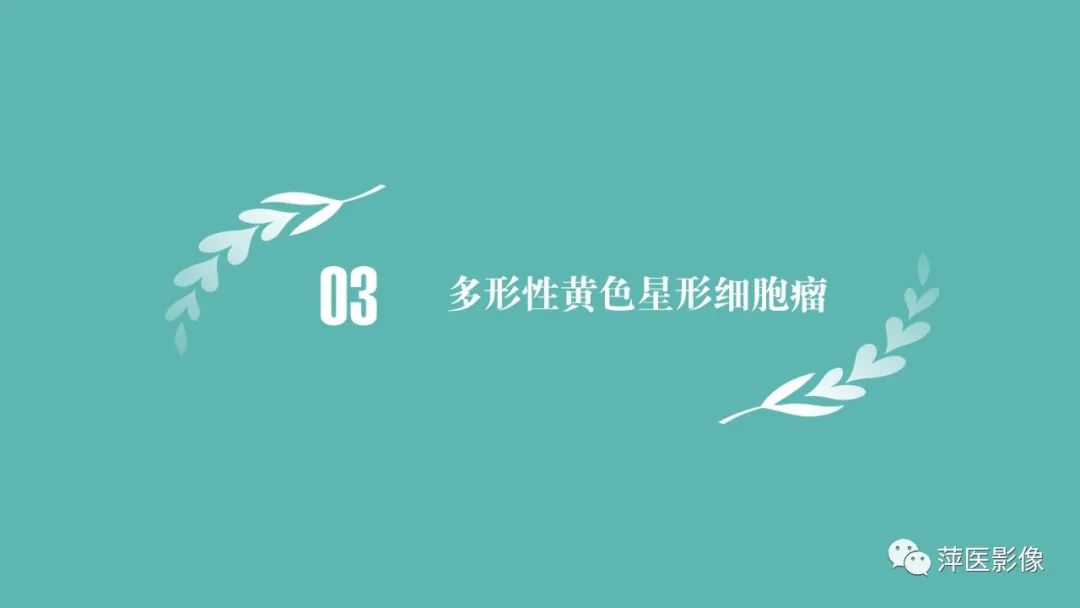 影像PPT - 【PPT】浅谈局限性星形细胞瘤-16