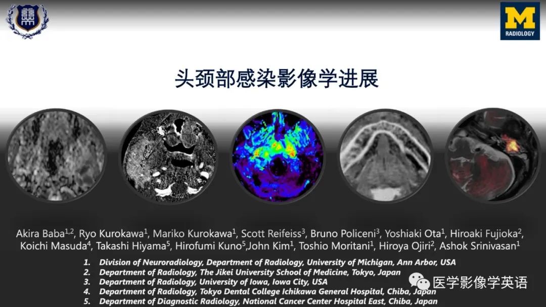 影像PPT - 【PPT】头颈部感染影像学进展-2 影像PPT - 【PPT】头颈部感染影像学进展-2