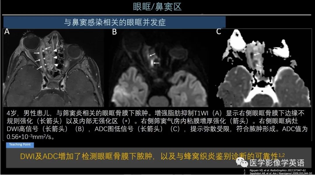 影像PPT - 【PPT】头颈部感染影像学进展-14 影像PPT - 【PPT】头颈部感染影像学进展-14