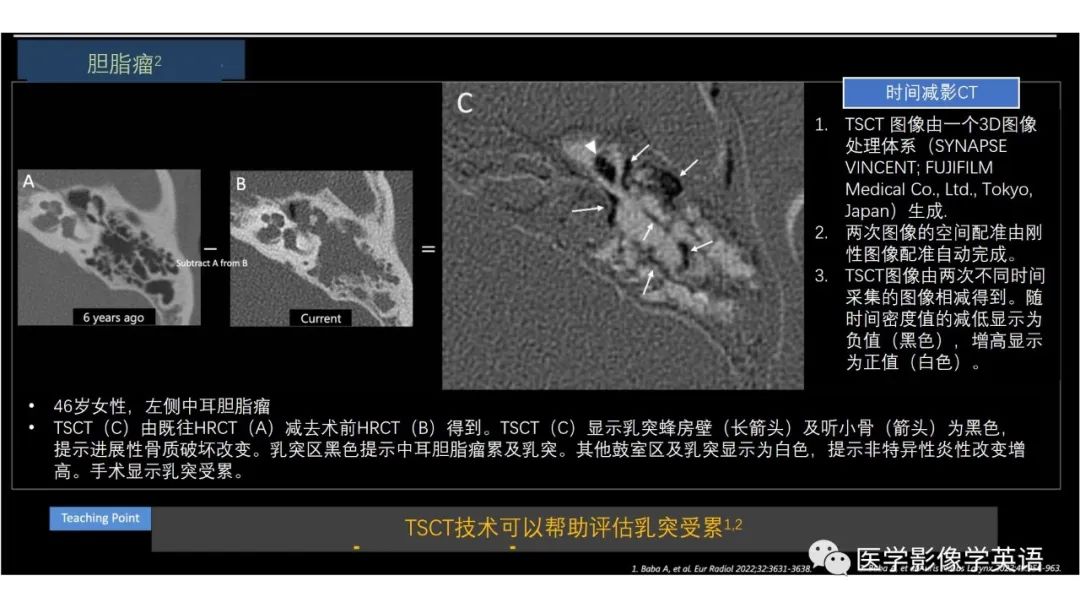 影像PPT - 【PPT】头颈部感染影像学进展-36 影像PPT - 【PPT】头颈部感染影像学进展-36