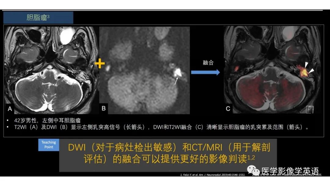 影像PPT - 【PPT】头颈部感染影像学进展-38 影像PPT - 【PPT】头颈部感染影像学进展-38
