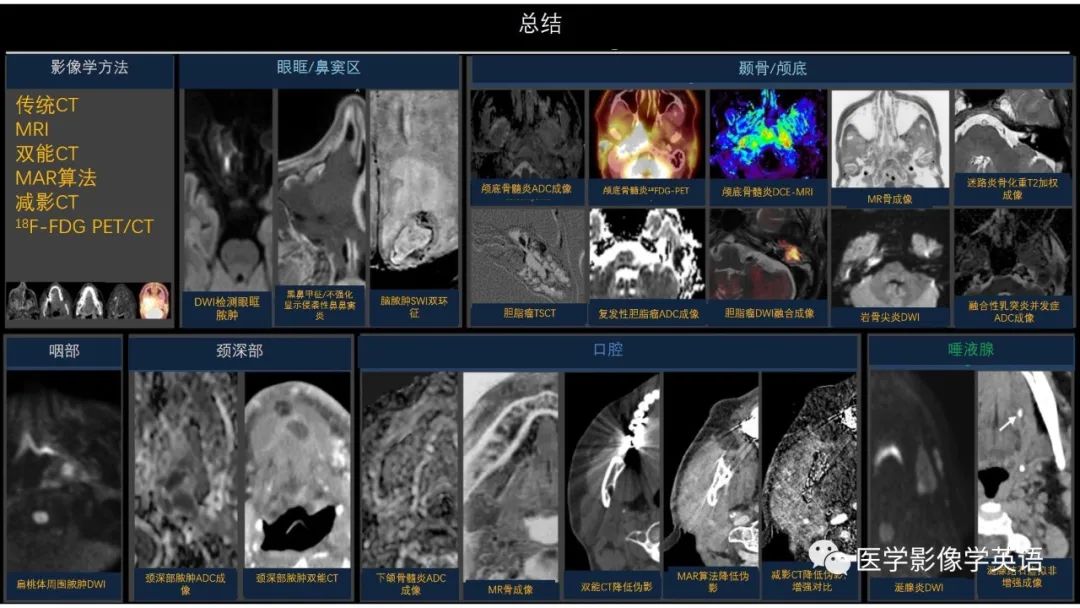 影像PPT - 【PPT】头颈部感染影像学进展-57 影像PPT - 【PPT】头颈部感染影像学进展-57