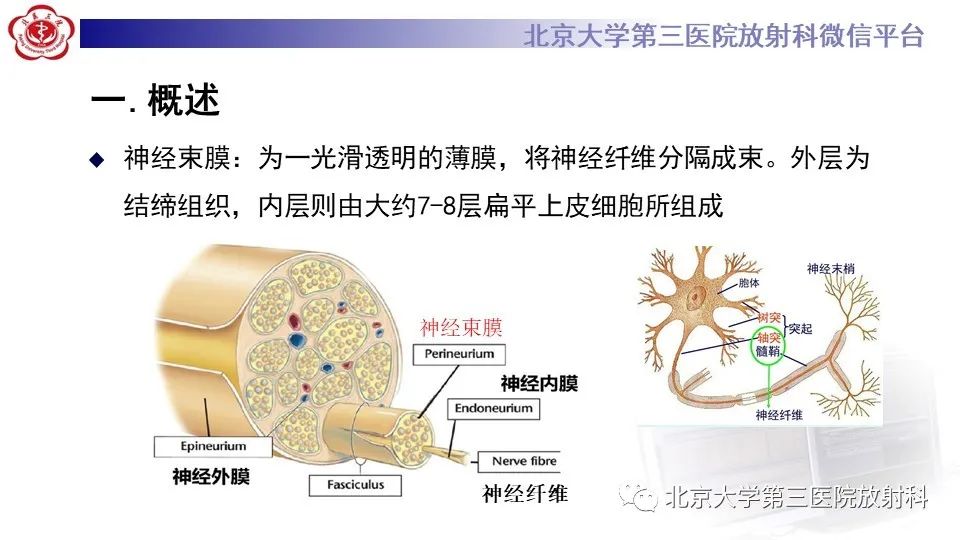 影像PPT - 【PPT】神经束脑膜瘤-12
