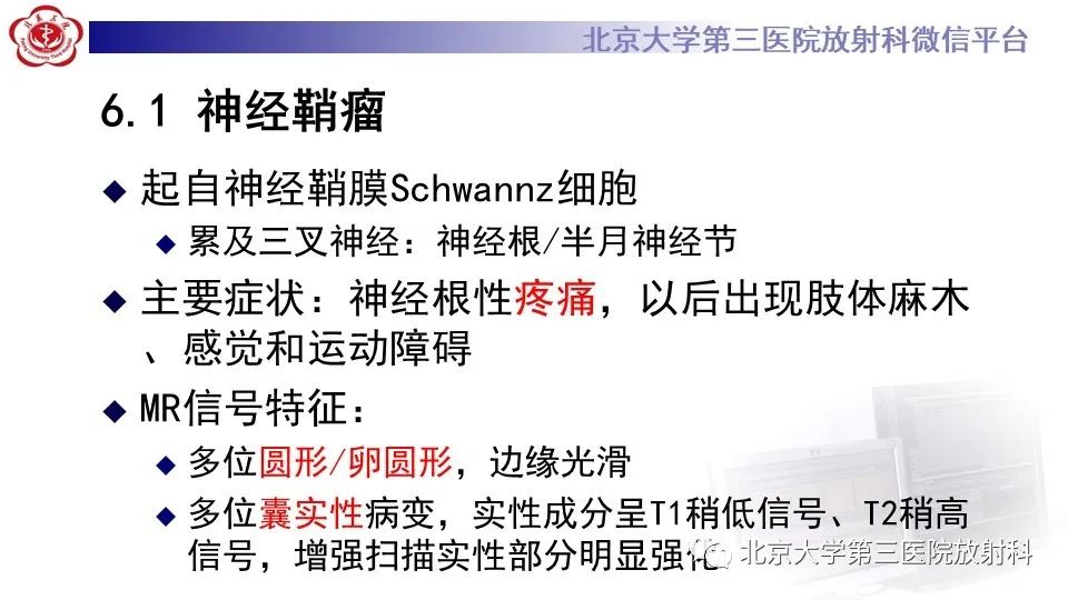 影像PPT - 【PPT】神经束脑膜瘤-22