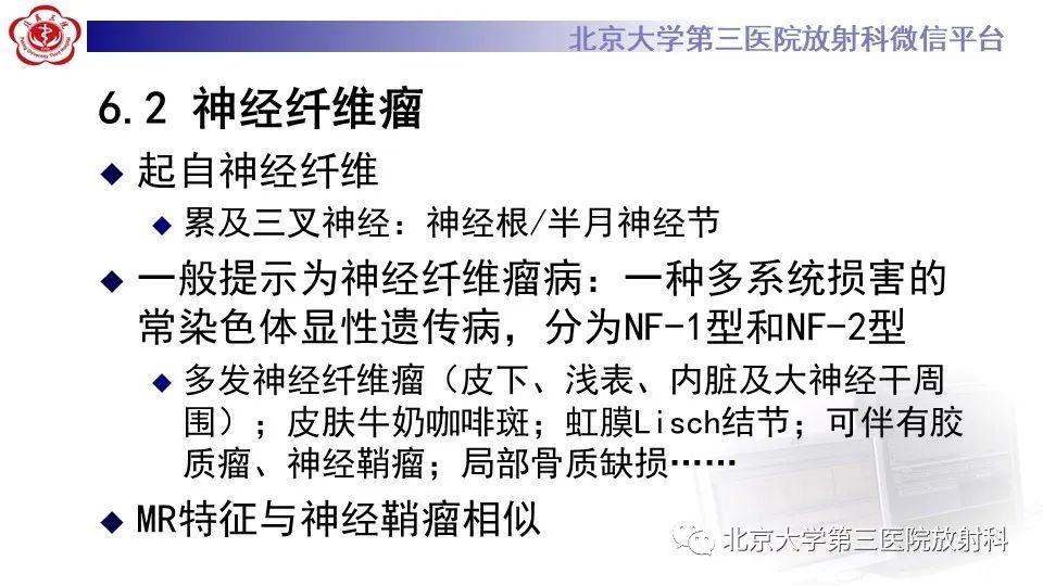 影像PPT - 【PPT】神经束脑膜瘤-24