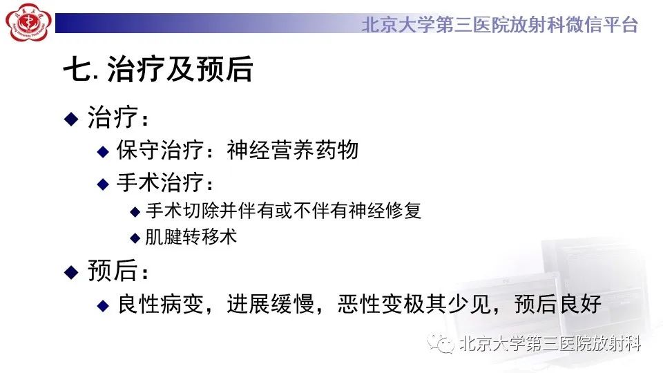 影像PPT - 【PPT】神经束脑膜瘤-25