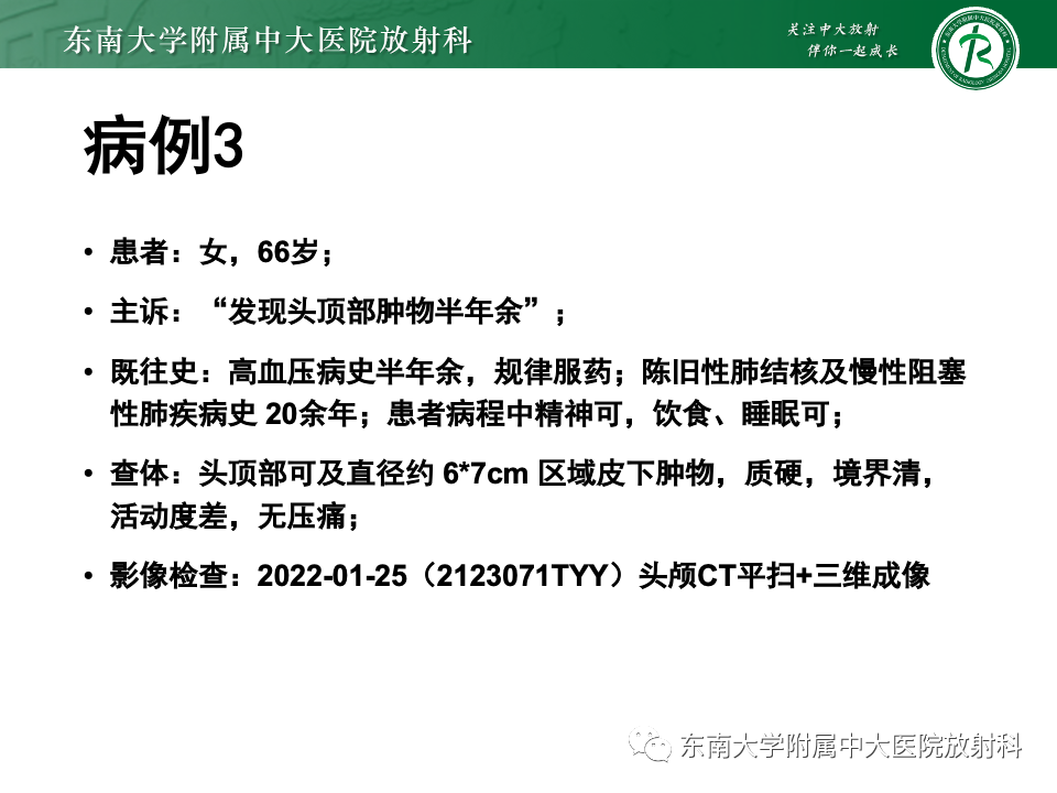 影像PPT - 【PPT】原发性颅骨海绵状血管瘤-14