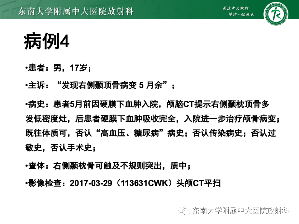 影像PPT - 【PPT】原发性颅骨海绵状血管瘤-18