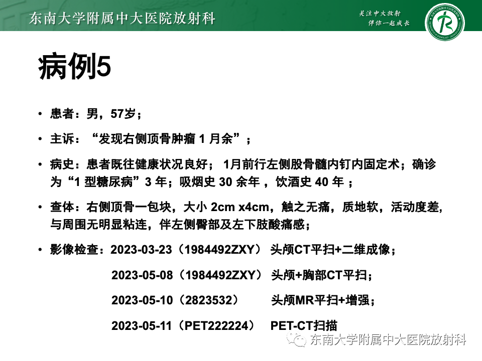 影像PPT - 【PPT】原发性颅骨海绵状血管瘤-30