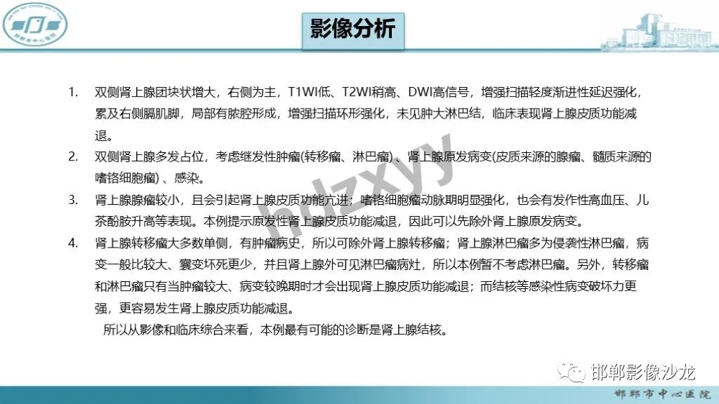 影像PPT - 【PPT】肾上腺结核-17