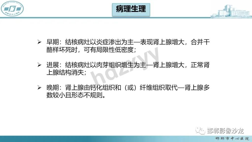 影像PPT - 【PPT】肾上腺结核-25