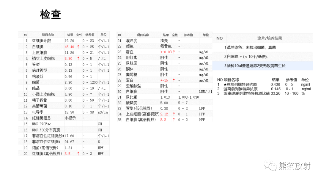 影像PPT - 【病例】腺性膀胱炎 VS 膀胱癌-7