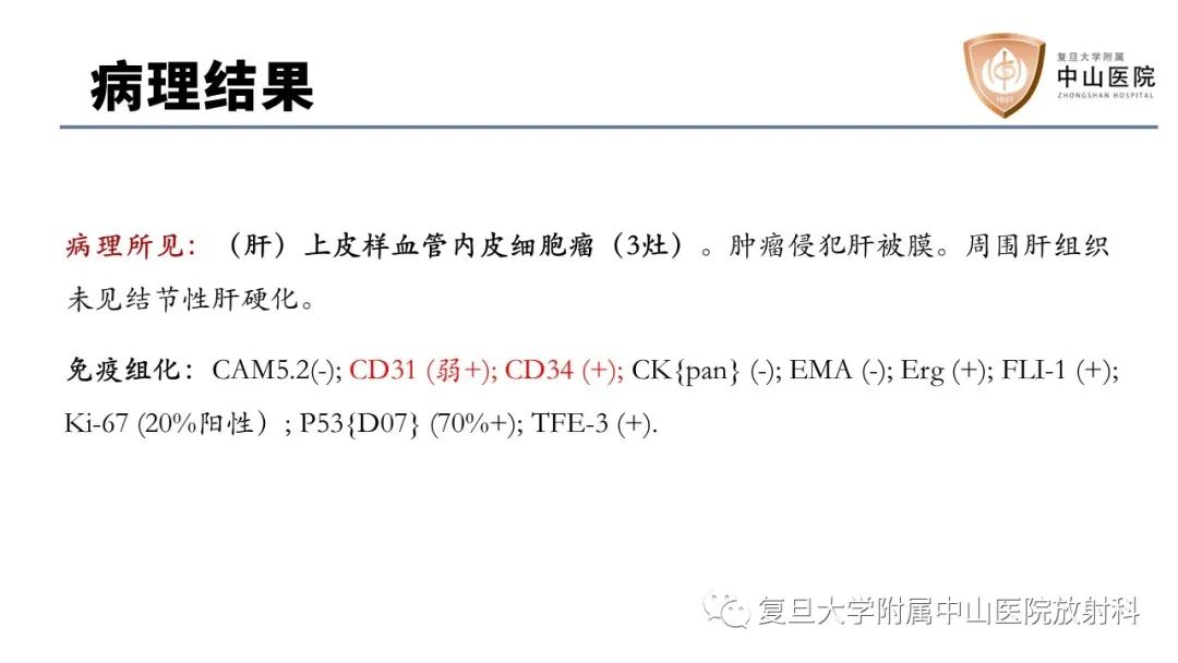 影像PPT - 【病例】肝脏上皮样血管内皮瘤1例MR影像-10