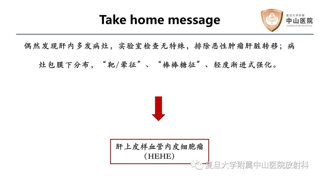 影像PPT - 【病例】肝脏上皮样血管内皮瘤1例MR影像-17
