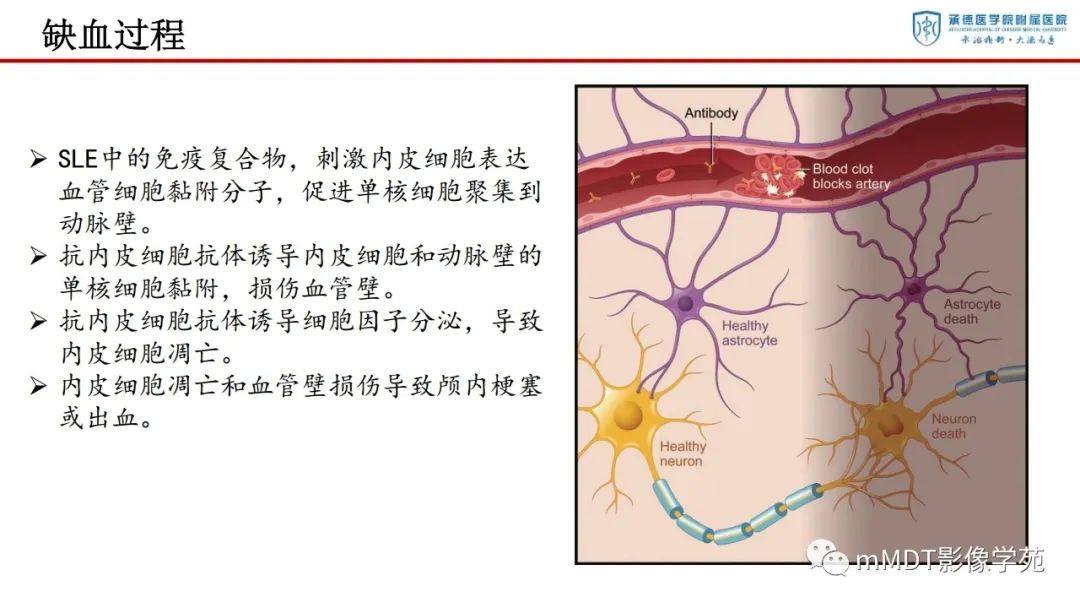 影像PPT - 【PPT】狼疮脑病的影像诊断-8