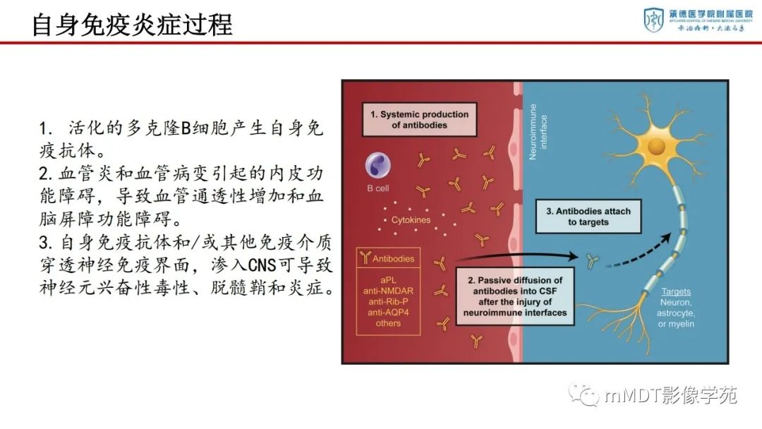 影像PPT - 【PPT】狼疮脑病的影像诊断-9
