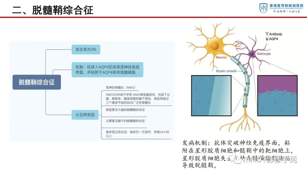 影像PPT - 【PPT】狼疮脑病的影像诊断-16