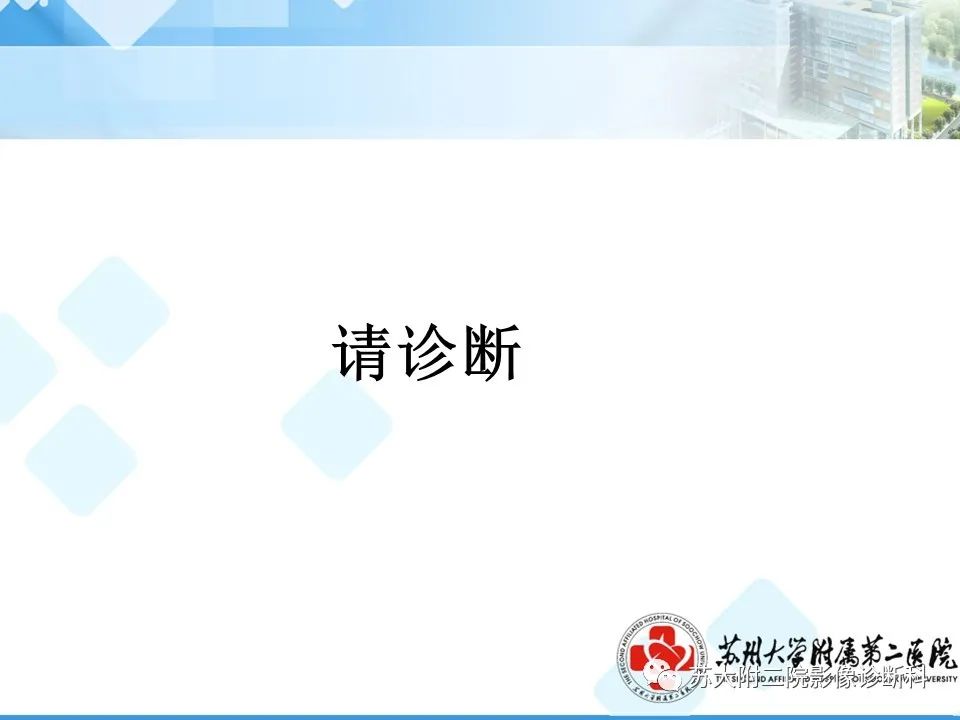 影像PPT - 【病例】卵巢Brenner瘤3例CT及MR影像-4