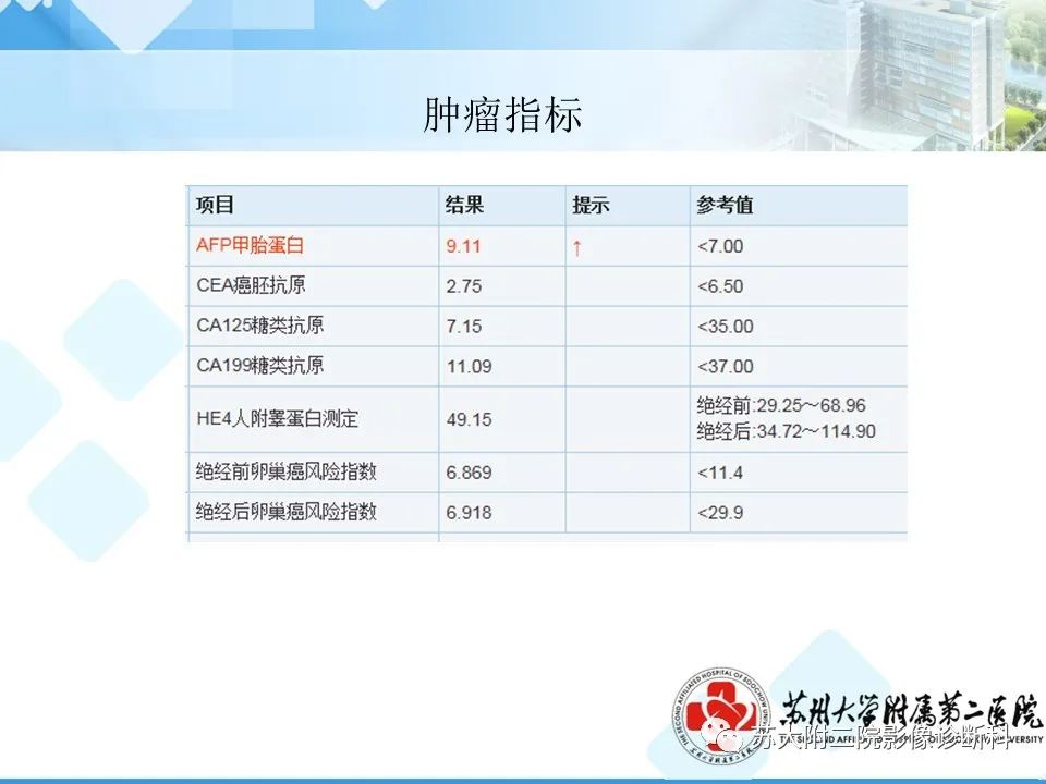影像PPT - 【病例】卵巢Brenner瘤3例CT及MR影像-8