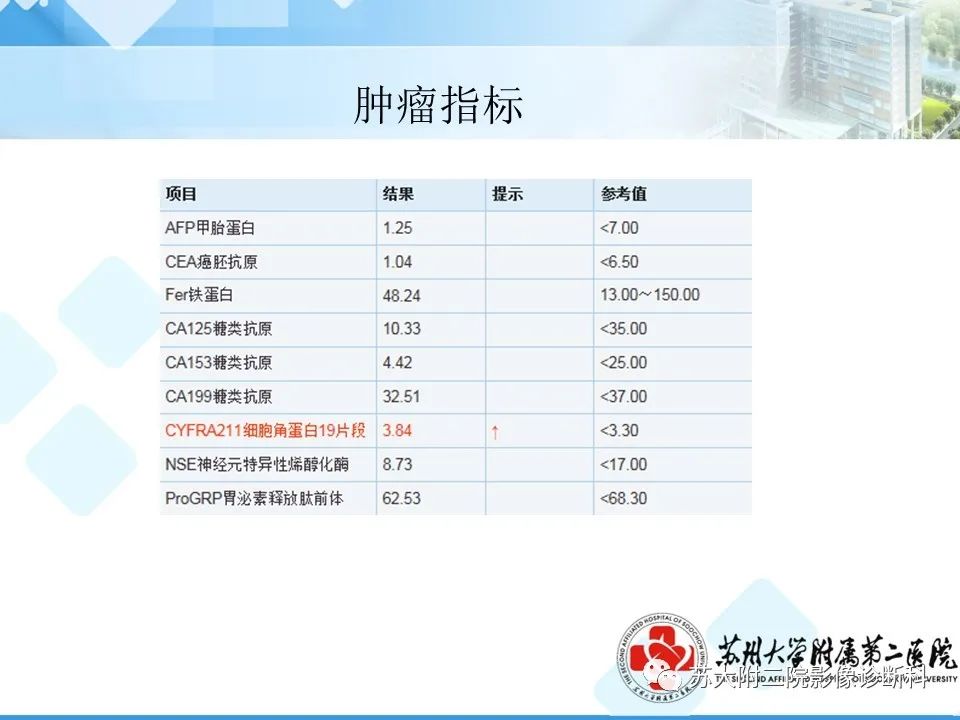 影像PPT - 【病例】卵巢Brenner瘤3例CT及MR影像-15