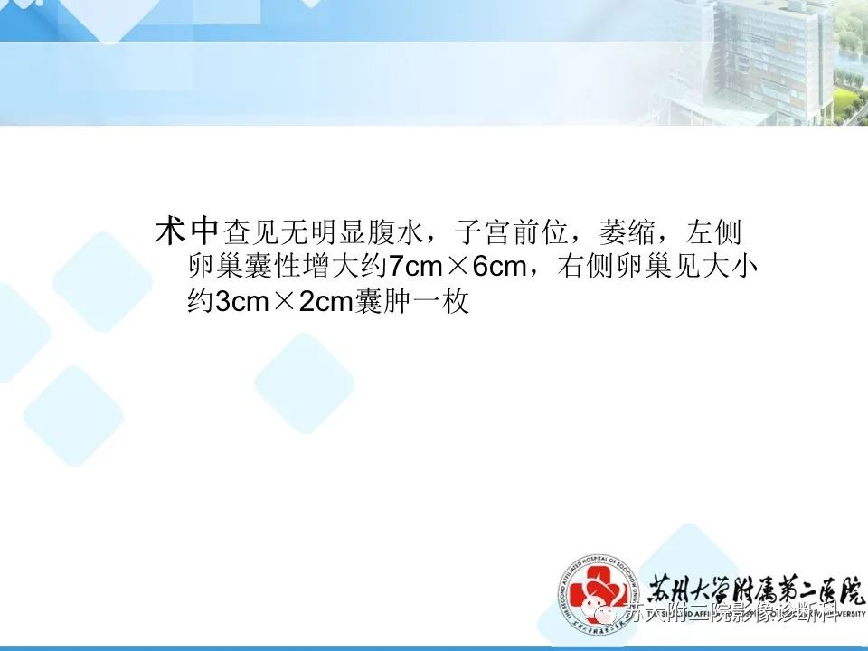 影像PPT - 【病例】卵巢Brenner瘤3例CT及MR影像-21