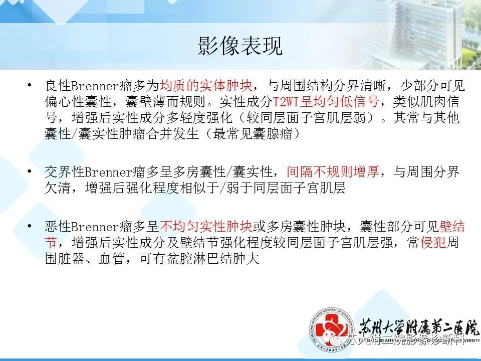 影像PPT - 【病例】卵巢Brenner瘤3例CT及MR影像-29