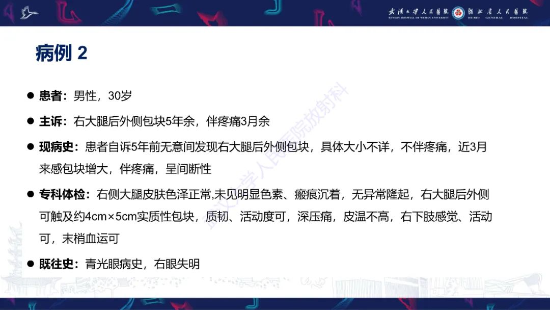 影像PPT - 【PPT】四肢血管源性肿瘤影像诊断-7