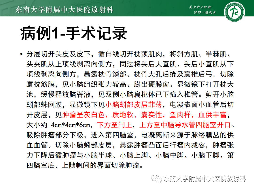 影像PPT - 【PPT】髓母细胞瘤-7