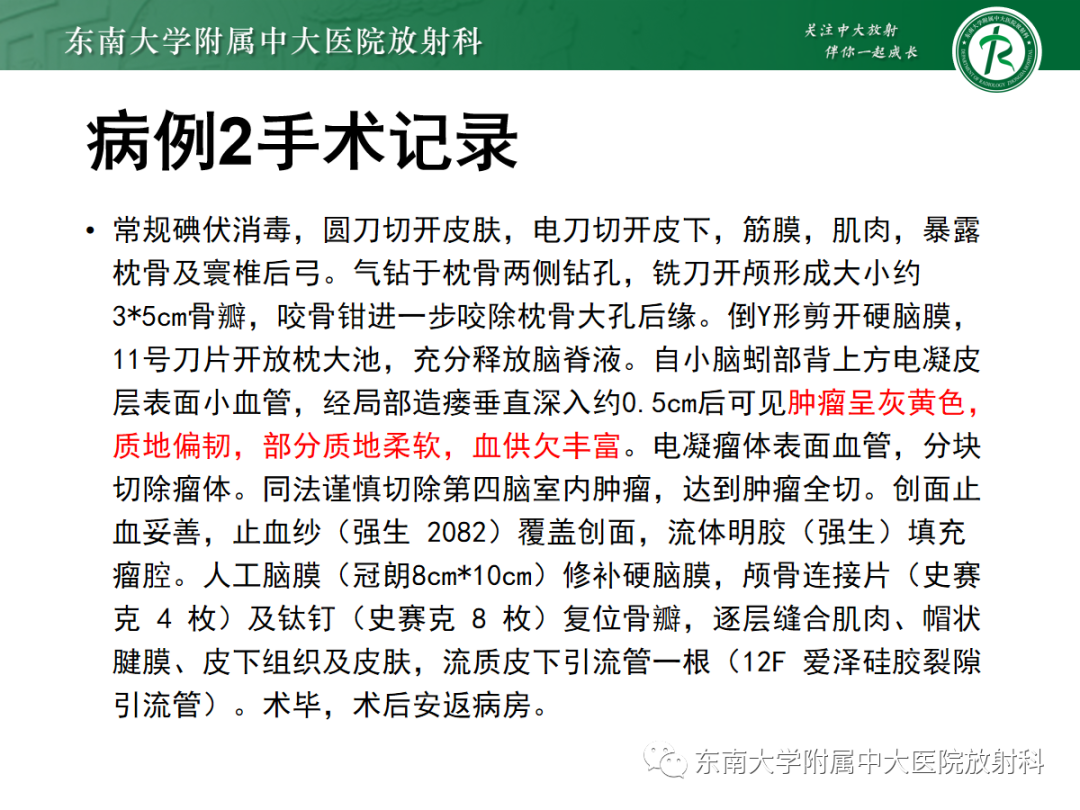 影像PPT - 【PPT】髓母细胞瘤-9