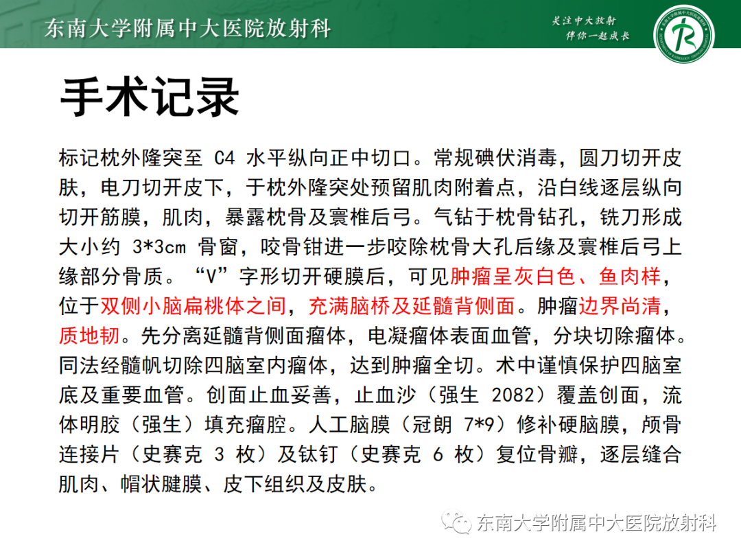 影像PPT - 【PPT】髓母细胞瘤-23