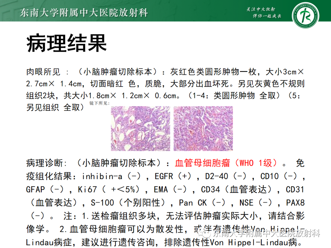 影像PPT - 【PPT】髓母细胞瘤-33