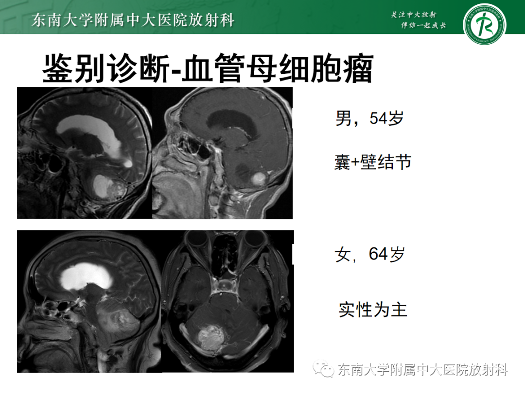 影像PPT - 【PPT】髓母细胞瘤-35