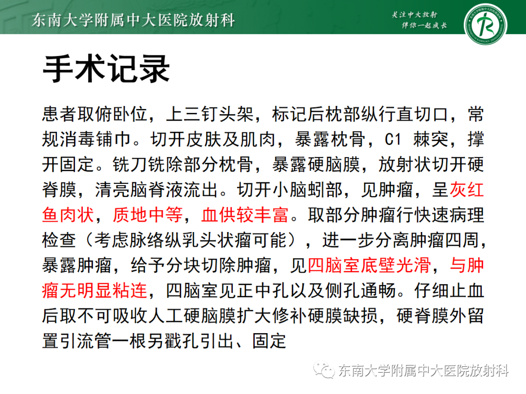 影像PPT - 【PPT】髓母细胞瘤-38